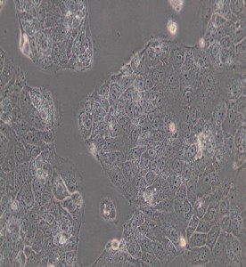 HuH-6人肝母細胞瘤細胞主圖