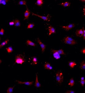 大鼠神經(jīng)小膠質(zhì)細(xì)胞主圖