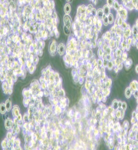 NCI-H524人小細(xì)胞肺癌細(xì)胞主圖