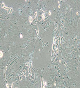 NCI-H2347人肺癌細(xì)胞主圖