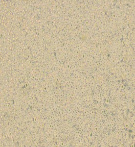 U266 [U266B1]人多發性骨髓瘤細胞主圖